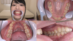 【歯フェチ】志田雪奈ちゃんの歯を観察しました！