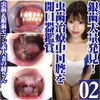 在Aya發現了大量的銀牙，朽爛的牙齒和銀牙七個妻子！在齲齒治療期間口腔欣賞口腔