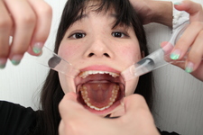 ♦ ️ [Dental fetish # 7] ♦ ️ New oral observation ⭐️HIKARI⭐️ by Oral hermit (Dr. X)‼ ️
