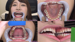 [Teeth fetishism] I observed the teeth of Momo Kato!