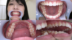 [牙齿恋物癖]我观察了Mihina的牙齿！
