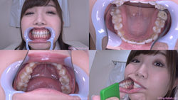 【歯フェチ】美泉咲ちゃんの歯を観察しました！【特典動画付】