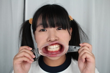 ♦️【歯フェチ #6】♦️ 新口腔内観察 ⭐️  MIWA 